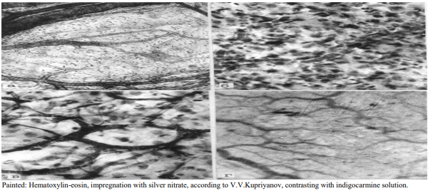 Figure 5: Structural organization of the pancreas microvasculatory bed 72 hours after modeling acute pancreatitis. A) Lymphatic collector and system of draining lymphatic vessels. Part of lymphcapillaries subjected to destruction; B) Total destruction of blood capillaries and hemorrhage into the area of the necrotic focus in the pancreas; C) Venous collector and destruction of part of the hemocapillaries with subsequent release of formed elements into the surrounding tissue; D) Indigocarmine fills only part of the lymphatic capillaries; empty and obstructed lymphatic capillaries are visible.